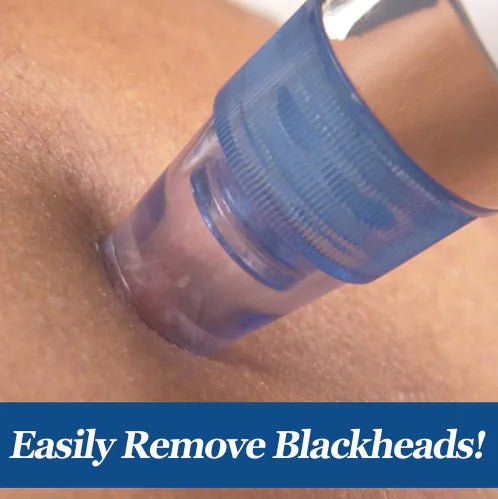 Electric Blackhead Remover Facial Cleansing Device