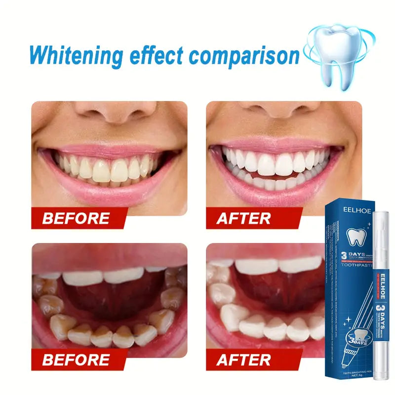 Teeth Whitening Pen - Effective, Painless, Travel-Friendly