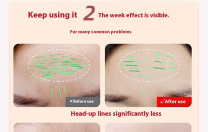 LED Red Light Therapy Facial Wand