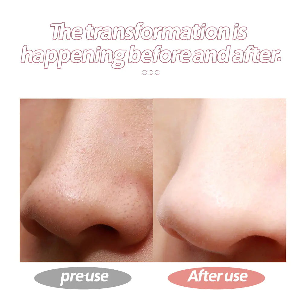 Ultrasonic Skin Scrubber for Home Beauty Care