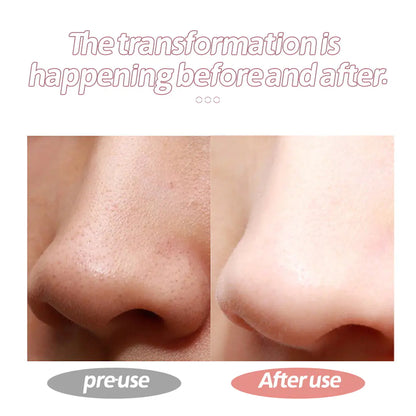 Ultrasonic Skin Scrubber for Home Beauty Care