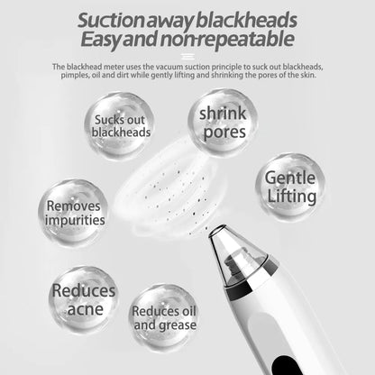 Portable Electric Blackhead Remover for Home Use