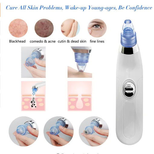 Electric Blackhead Remover Facial Cleansing Device