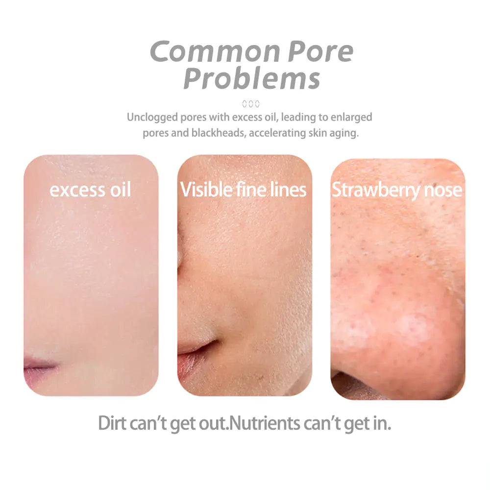 Ultrasonic Skin Scrubber for Home Use and Pore Cleansing