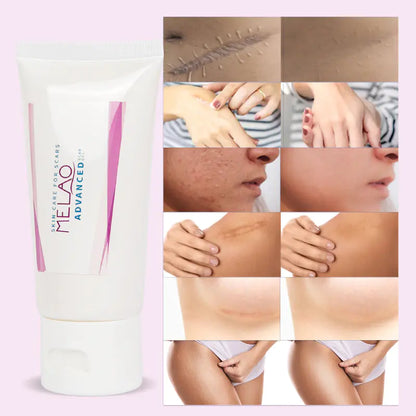 MELAO Scar Removal Gel for Stretch Marks and Acne Repair