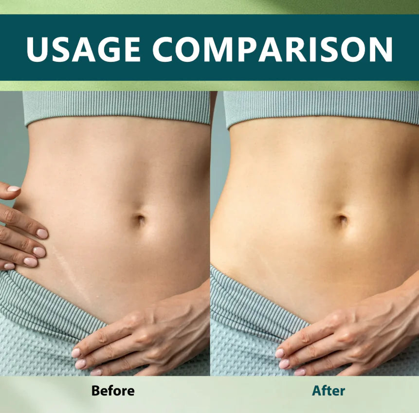 Silicone Scar Gel Patch