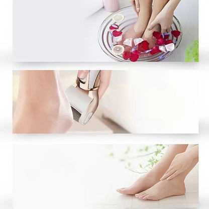 Rechargeable Electric Foot Callus Remover Kit